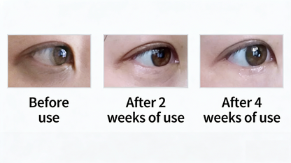 Meishoku Placenta Whitening, Moisturizing & Firming Eye Cream 30g/ For Tired Eyes